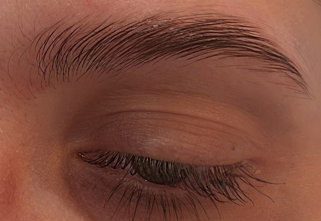 Sourcils après browlift